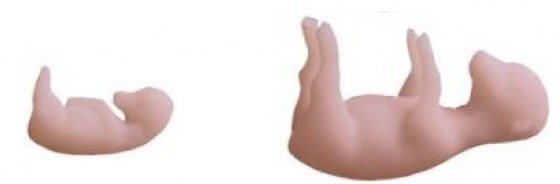 Sada patologick&yacute;ch děloh (teriogenologie)-1